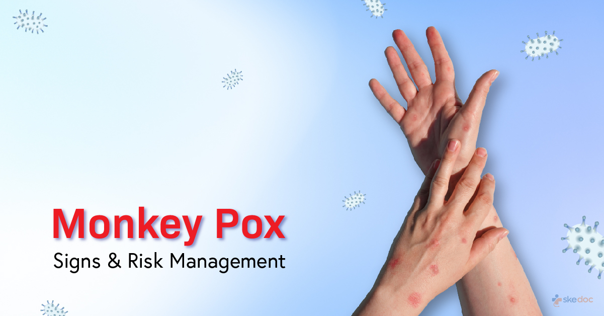 Are you scared of Monkeypox - Know it's Signs, Risk Management