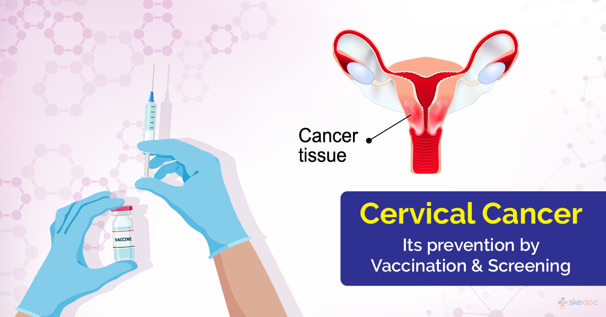 Cervical Cancer : Its Prevention by Vaccination and Screening