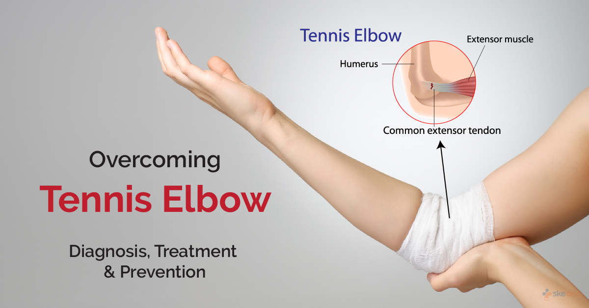 Overcoming Tennis Elbow