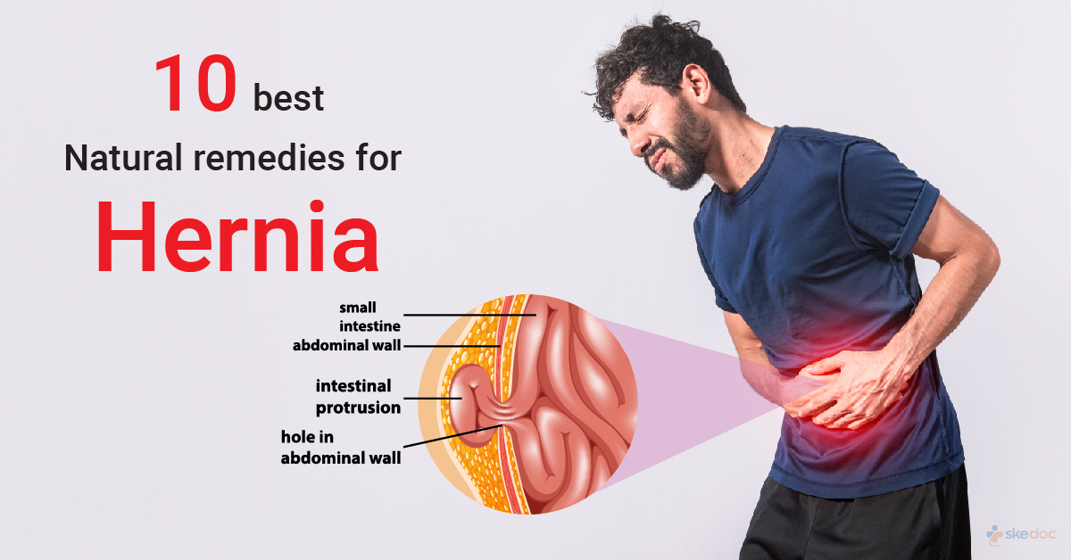 Best Natural Remedies For Hernia