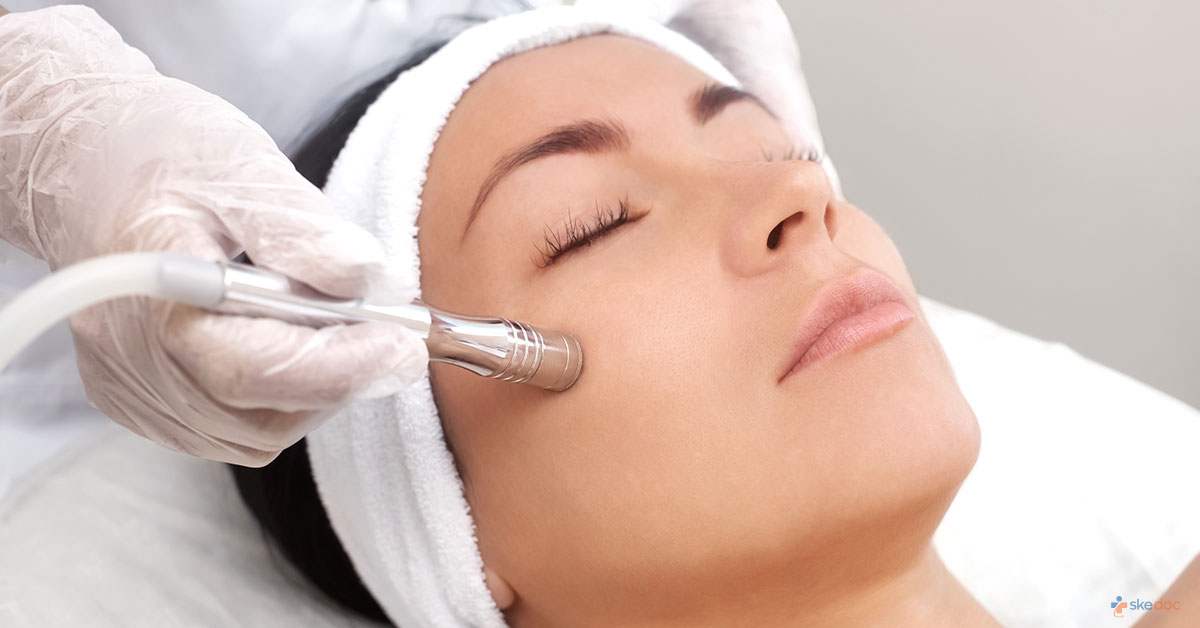 What to know about Microdermabrasion?